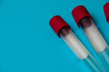 Coronavirus ilaç ve tedavi konsepti. Yeni korona virüsü salgını tespit edildiğinde kan test tüpleri