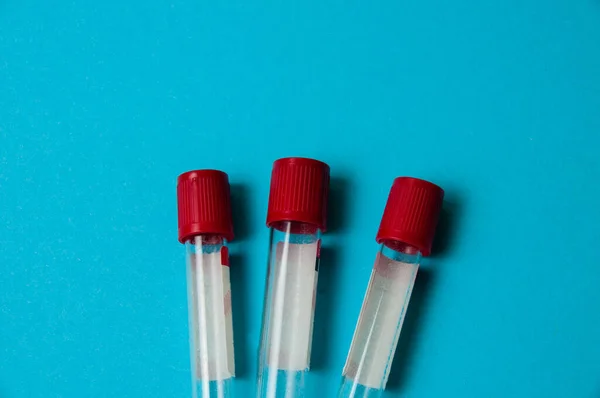 Medicina Del Coronavirus Concepto Tratamiento Tubos Análisis Sangre Final Detección —  Fotos de Stock