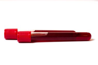 Beyaz arka planda kan izole edilmiş iki test tüpü. Tıp konsepti, virüslerle ve bakterilerle mücadele, hastalıklar.