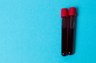 Mavi arka planda kan izole edilmiş iki test tüpü. Tıp konsepti, virüslerle ve bakterilerle mücadele, hastalıklar.