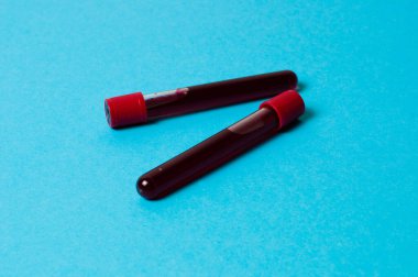 Mavi arka planda kan izole edilmiş iki test tüpü. Tıp konsepti, virüslerle ve bakterilerle mücadele, hastalıklar.