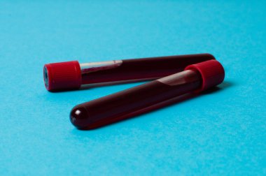 Mavi arka planda kan izole edilmiş iki test tüpü. Tıp konsepti, virüslerle ve bakterilerle mücadele, hastalıklar.