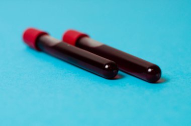 Mavi arka planda kan izole edilmiş iki test tüpü. Tıp konsepti, virüslerle ve bakterilerle mücadele, hastalıklar.