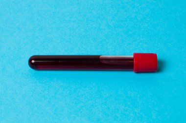 Mavi arkaplanda kan izolasyonu olan test tüpü