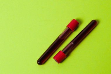 Yeşil arka planda kan izole edilmiş iki test tüpü. Tıp kavramı, virüslerle ve bakterilerle mücadele, hastalıklar