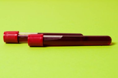 Yeşil arka planda kan izole edilmiş iki test tüpü. Tıp kavramı, virüslerle ve bakterilerle mücadele, hastalıklar