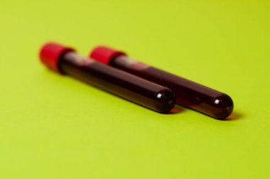 Yeşil arka planda kan izole edilmiş iki test tüpü. Tıp kavramı, virüslerle ve bakterilerle mücadele, hastalıklar