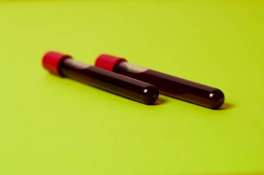 Yeşil arka planda kan izole edilmiş iki test tüpü. Tıp kavramı, virüslerle ve bakterilerle mücadele, hastalıklar