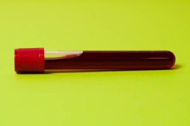 Yeşil arkaplanda kan izolasyonu olan test tüpü