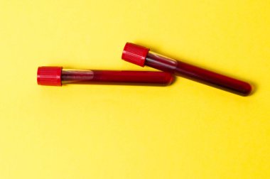 Sarı arka planda kan izole edilmiş iki test tüpü. Tıp kavramı, virüslerle ve bakterilerle mücadele, hastalıklar