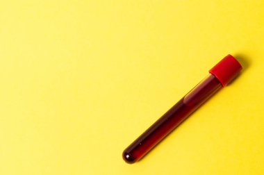 Sarı arka planda kan izole test tüpü