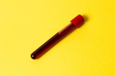 Sarı arka planda kan izole test tüpü