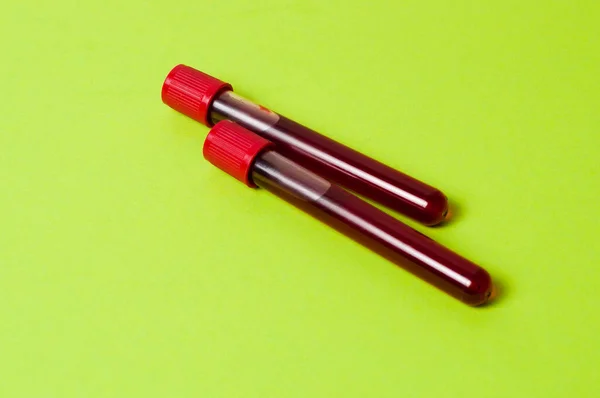 Two Test Tubes Blood Isolate Green Background Concept Medicine Fight — Stock Photo, Image