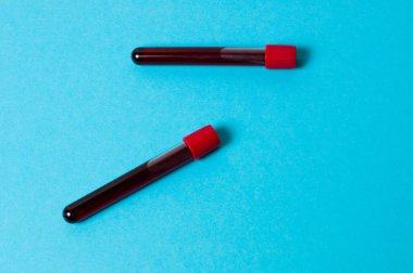 Mavi arka planda kan izole edilmiş iki test tüpü. Tıp konsepti, virüslerle ve bakterilerle mücadele, hastalıklar.