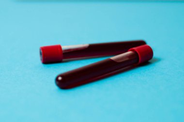 Mavi arka planda kan izole edilmiş iki test tüpü. Tıp konsepti, virüslerle ve bakterilerle mücadele, hastalıklar.