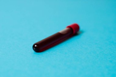 Mavi arkaplanda kan izolasyonu olan test tüpü