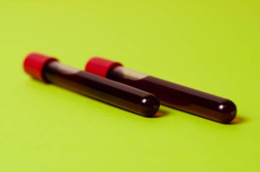 Yeşil arka planda kan izole edilmiş iki test tüpü. Tıp kavramı, virüslerle ve bakterilerle mücadele, hastalıklar