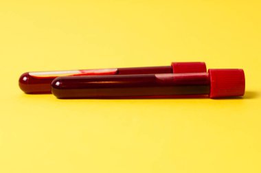 Sarı arka planda kan izole edilmiş iki test tüpü. Tıp kavramı, virüslerle ve bakterilerle mücadele, hastalıklar