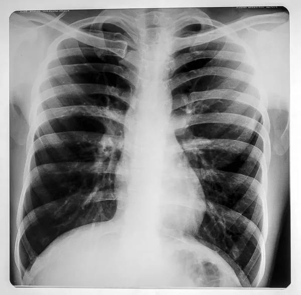 Röntgensugarak — Stock Fotó