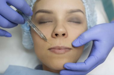 Top view of lips augmentation procedure on a young woman done by a cosmetologist doctor with Hyaluronic acid Injection.