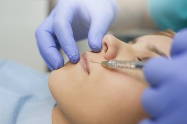 lateral view of lips augmentation procedure on a young woman done by a cosmetologist doctor with Hyaluronic acid Injection.
