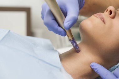 Daha sonra boyunda mikro dermabrasiasyon olan bir kadın görülüyor.