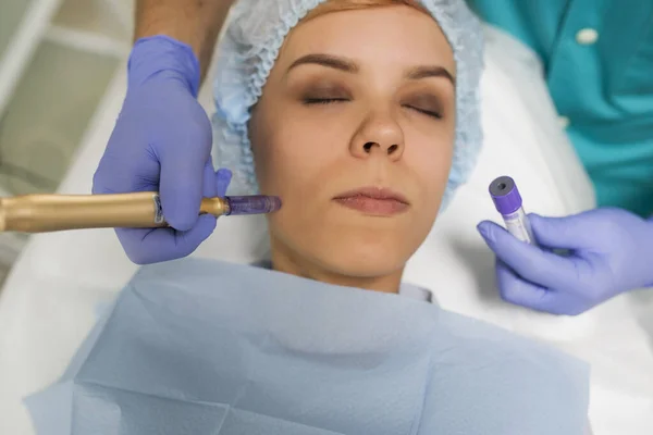 Closeup Woman Recieving Cheek Microdermabrasion Procedure — Stok fotoğraf