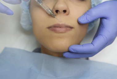 Top view of lips augmentation procedure on a young woman done by a cosmetologist doctor with Hyaluronic acid Injection.