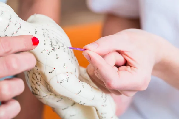 Médico alternativo que explica a acupuntura — Fotografia de Stock