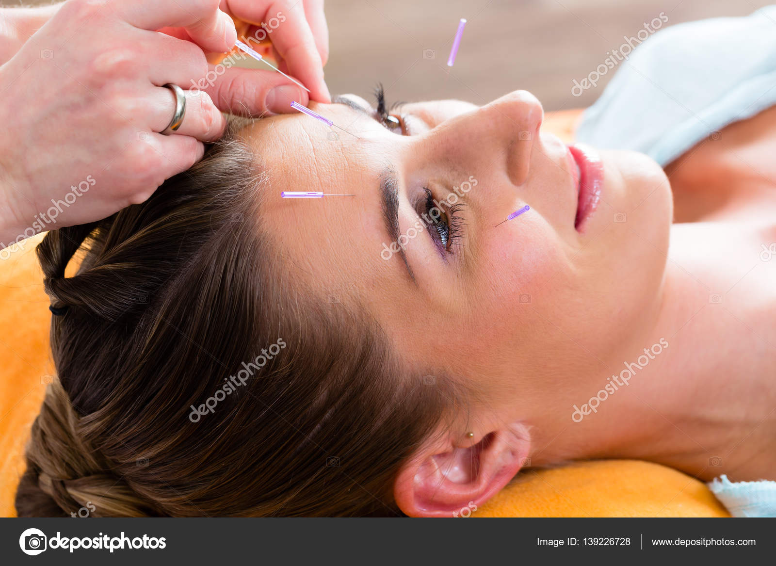 Therapist setting acupuncture needles — Stock Photo © Kzenon 139226728
