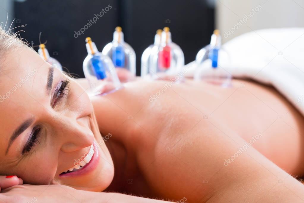 Alternative practitioner cupping woman