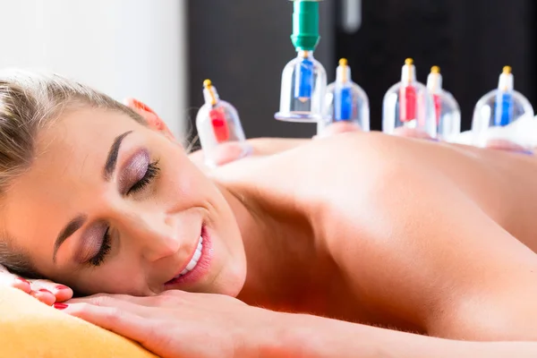 Vrouw in cupping therapie — Stockfoto