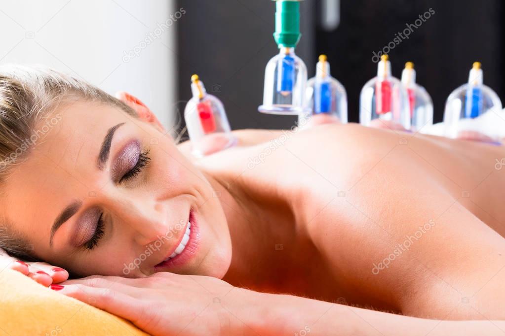 Woman in cupping therapy