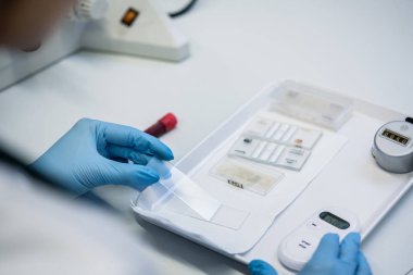 Kan testi hazırlanıyor laborant yakın çekim