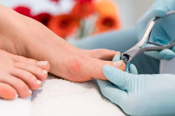 Primer plano de las manos de un pedicurista con guantes quirúrgicos — Foto de Stock