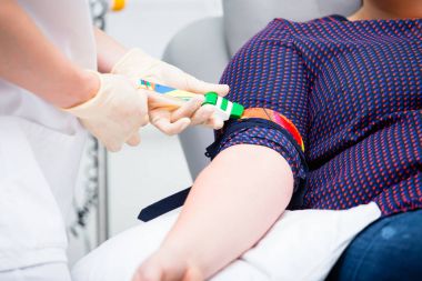 Kan bağışı, ven kateteri