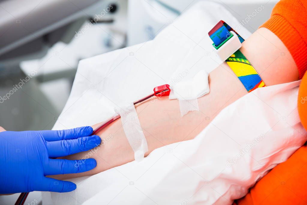 Vein catheter at blood donation