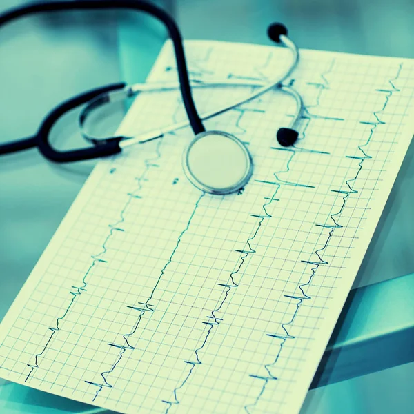 Stethoscoop en elektrocardiogram op de tafel van de therapeut — Stockfoto