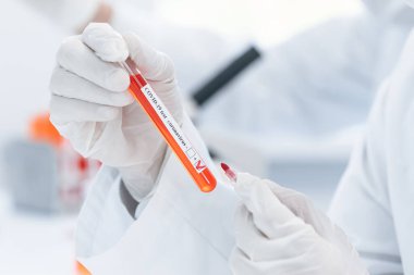 Bir laboratuvar çalışanının ellerinde test edilmiş bir tüp..