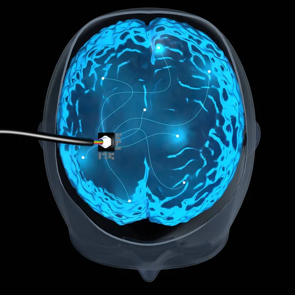 Conceito de cérebro com fio — Fotografia de Stock
