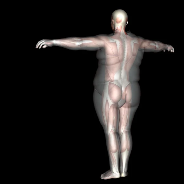 Übergewicht gegen schlanke Figur — Stockfoto