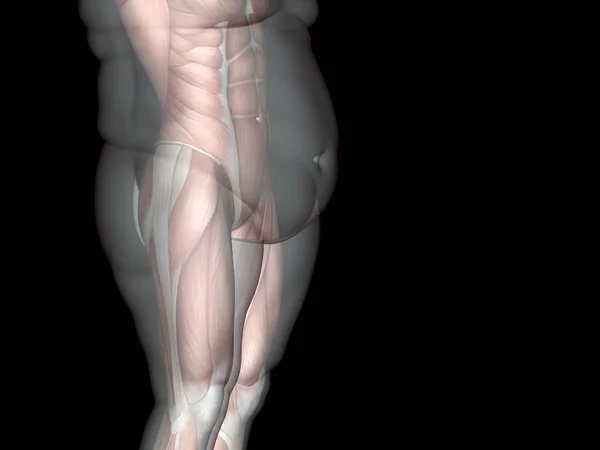 Надмірна вага проти стрункої людини — стокове фото