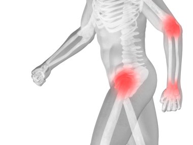 insan ile eklem kas veya kemik ağrısı