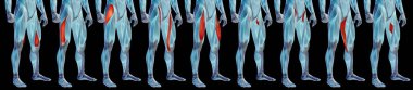 üst bacak anatomisi