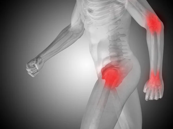 Human body with articular pain — Stock Photo, Image