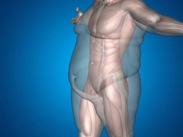 Nadváhu vs slim fit s svaly — Stock fotografie