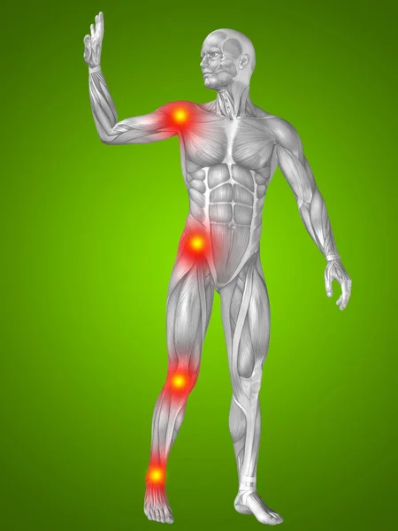 Mänskliga muskler med artikulär eller ben smärta — Stockfoto