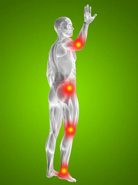 Músculos humanos com dor articular ou óssea — Fotografia de Stock