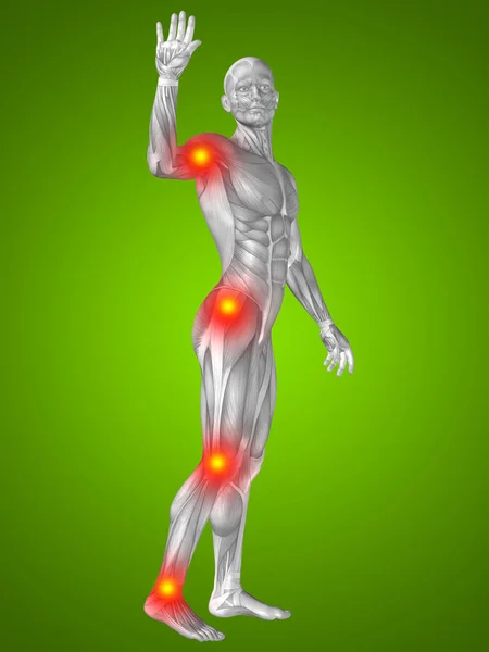Mens met articulaire spieren of botten pijn — Stockfoto