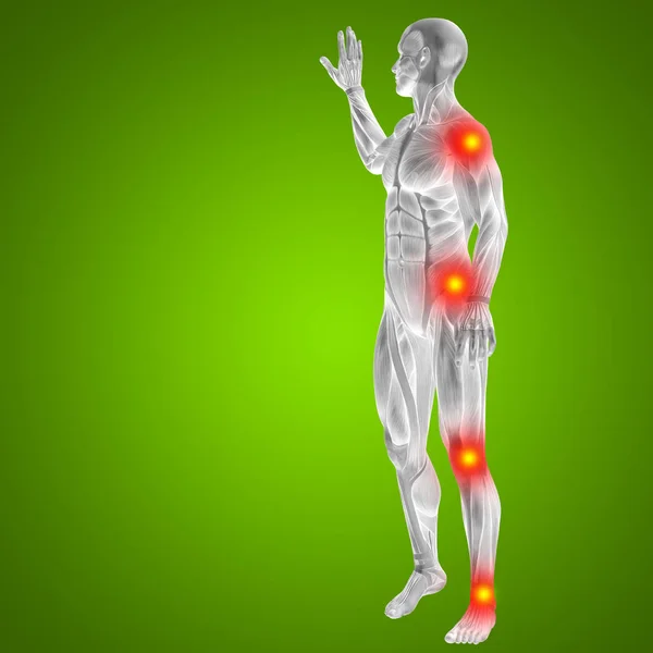 Mänskliga kroppen med artikulära smärta — Stockfoto